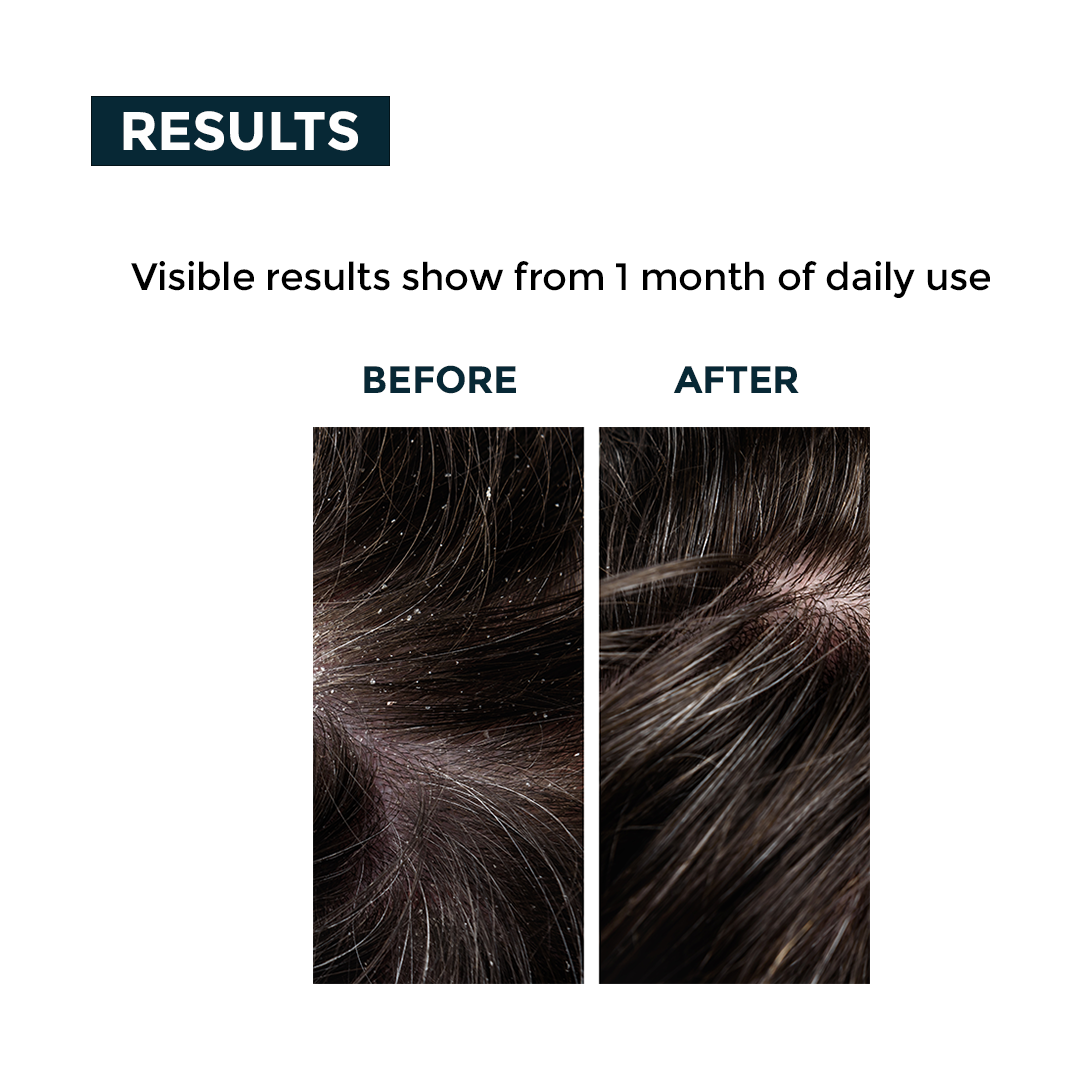 Nerbon Hair Fall & Dandruff Control Conditioner