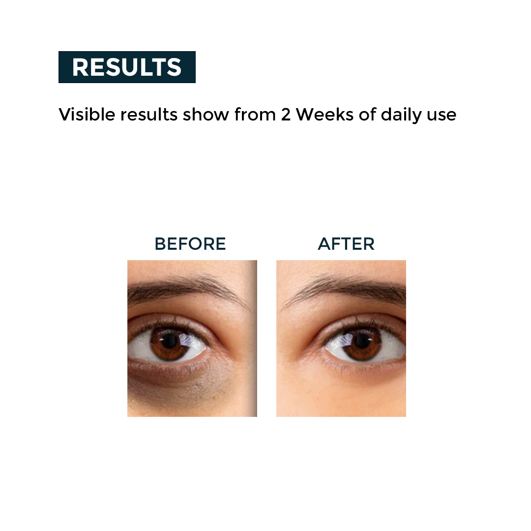 Nerbon Skin Repair Gel – Soothing & Healing Formula