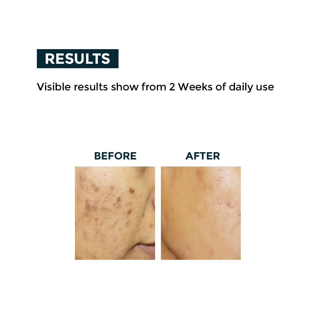 Nerbon Vitamin C Face Serum – Brightening & Glow Boost